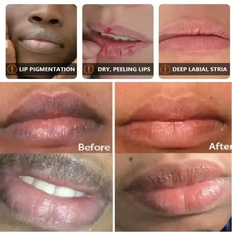 Maxy Remove Dark Lip Balm Lightening Melanin Mask Gloss Exfoliating Lip Pink Treatment Reduce Lip Lines Improve Dryness Moisturizing