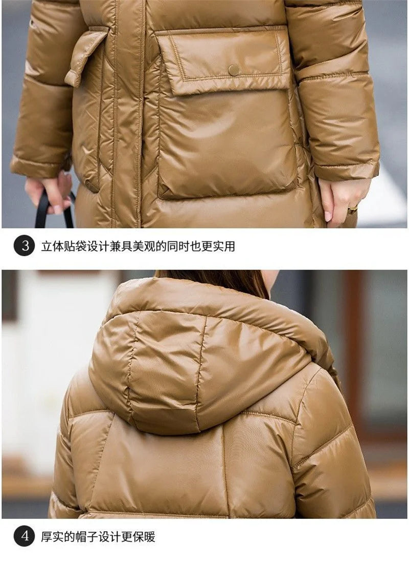 Maxy Temperament Loose Women's Winter New Fashion Korean Down Cotton-Padded Jacket Fat Sister Slim Keep Warm Cotton-Bread Service