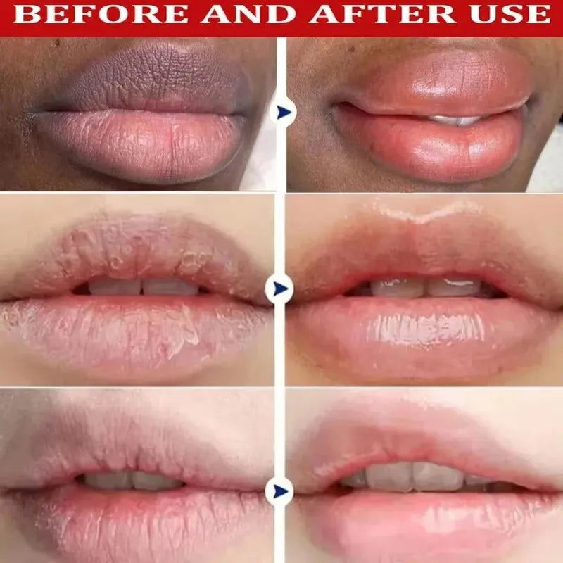 Maxy Remove Dark Lip Balm Lightening Melanin Mask Gloss Exfoliating Lip Pink Treatment Reduce Lip Lines Improve Dryness Moisturizing